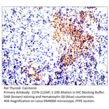 Anti-Calcitonin Antibody from FabGennix (CLTN-112AP) - Antibodies.com