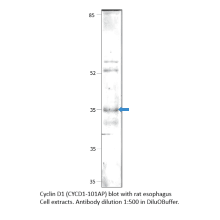 Anti-Cyclin D1 Antibody from FabGennix (CYCD1-101AP) - Antibodies.com