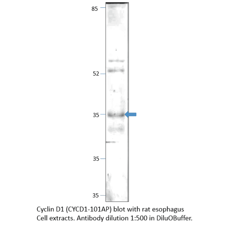 Anti-Cyclin D1 Antibody from FabGennix (CYCD1-101AP) - Antibodies.com