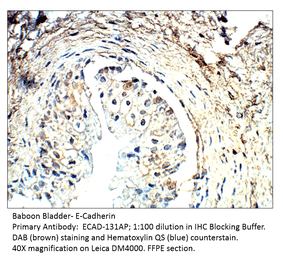 Anti-E-Cadherin Antibody from FabGennix (ECAD-131AP) - Antibodies.com