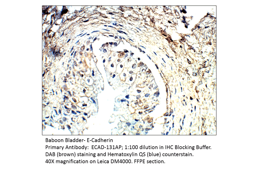 Anti-E-Cadherin Antibody from FabGennix (ECAD-131AP) - Antibodies.com
