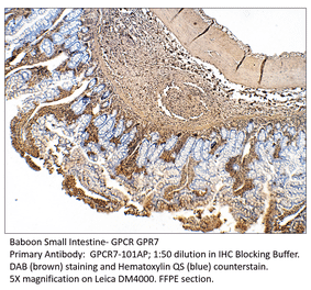 Anti-GPCR GPR7 Antibody from FabGennix (GPCR7-101AP) - Antibodies.com