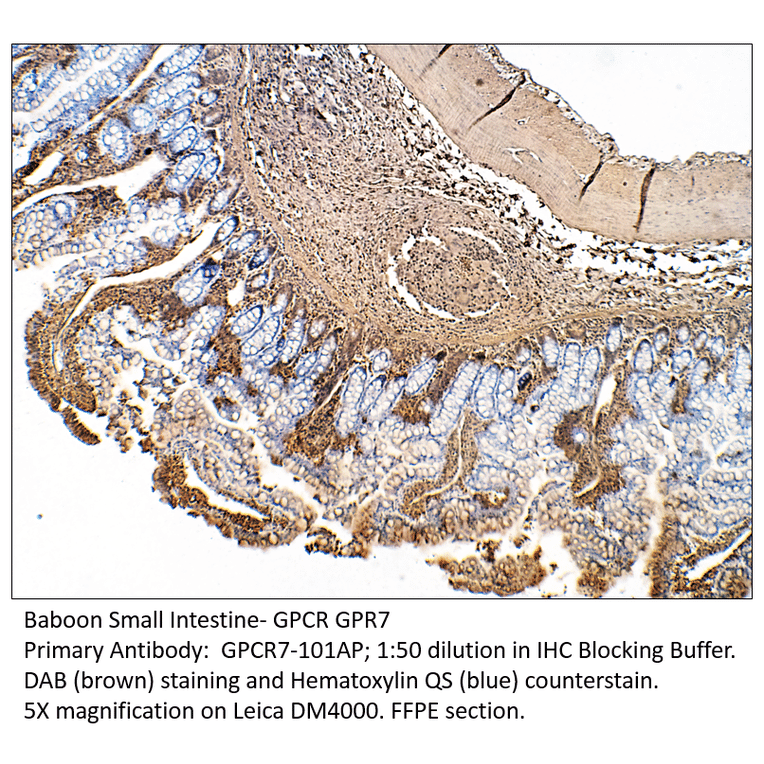 Anti-GPCR GPR7 Antibody from FabGennix (GPCR7-101AP) - Antibodies.com