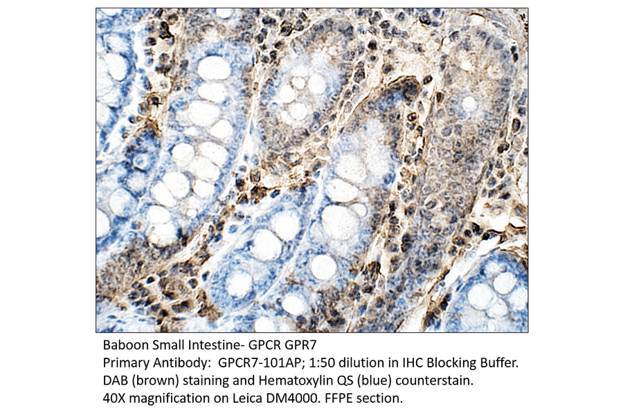 Anti-GPCR GPR7 Antibody from FabGennix (GPCR7-101AP) - Antibodies.com
