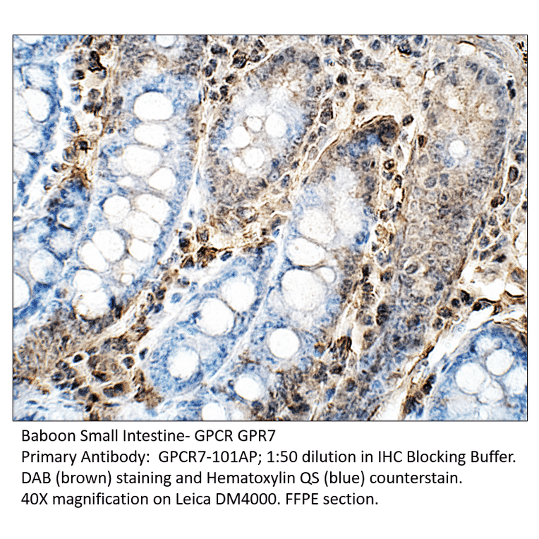 Anti-GPCR GPR7 Antibody from FabGennix (GPCR7-101AP) - Antibodies.com