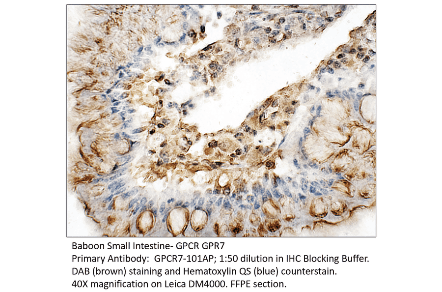 Anti-GPCR GPR7 Antibody from FabGennix (GPCR7-101AP) - Antibodies.com