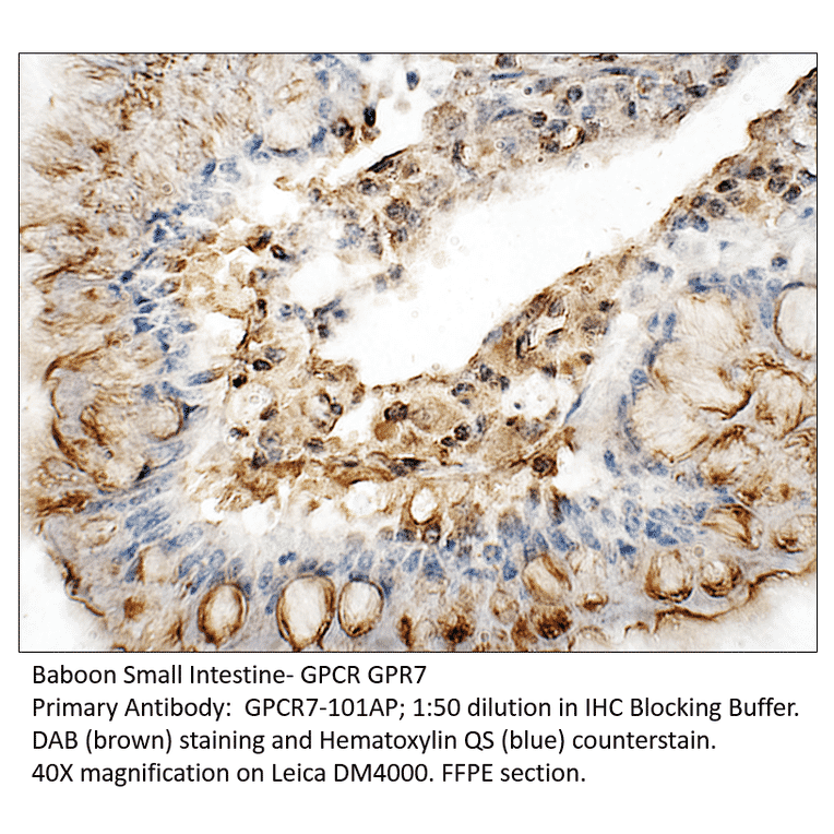 Anti-GPCR GPR7 Antibody from FabGennix (GPCR7-101AP) - Antibodies.com