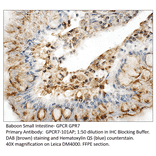 Anti-GPCR GPR7 Antibody from FabGennix (GPCR7-101AP) - Antibodies.com