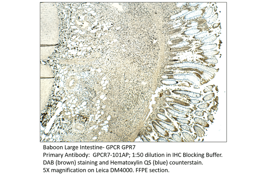 Anti-GPCR GPR7 Antibody from FabGennix (GPCR7-101AP) - Antibodies.com