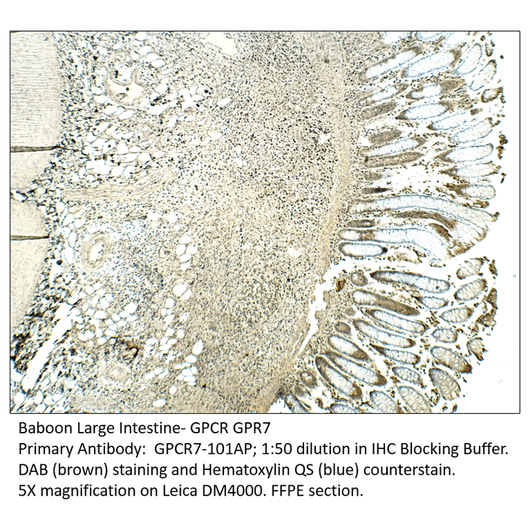 Anti-GPCR GPR7 Antibody from FabGennix (GPCR7-101AP) - Antibodies.com