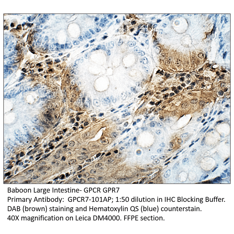 Anti-GPCR GPR7 Antibody from FabGennix (GPCR7-101AP) - Antibodies.com