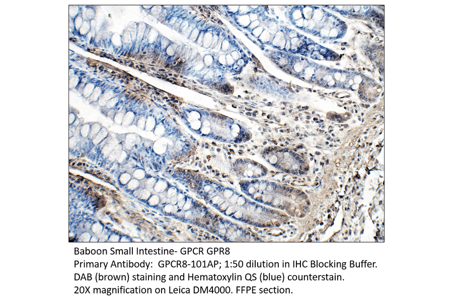 Anti-GPCR GPR8 Antibody from FabGennix (GPCR8-101AP) - Antibodies.com