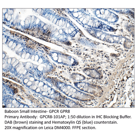Anti-GPCR GPR8 Antibody from FabGennix (GPCR8-101AP) - Antibodies.com