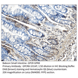 Anti-GPCR GPR8 Antibody from FabGennix (GPCR8-101AP) - Antibodies.com