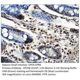 Anti-GPCR GPR8 Antibody from FabGennix (GPCR8-101AP) - Antibodies.com