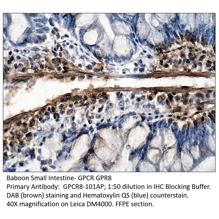 Anti-GPCR GPR8 Antibody from FabGennix (GPCR8-101AP) - Antibodies.com