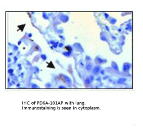 Anti-PDE6 Alpha Antibody from FabGennix (PD6A-101AP) - Antibodies.com