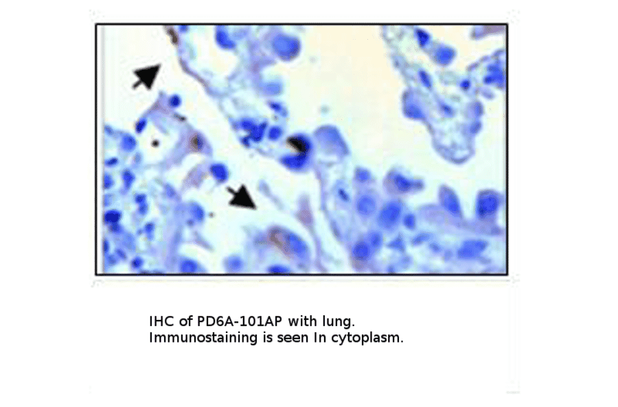 Anti-PDE6 Alpha Antibody from FabGennix (PD6A-101AP) - Antibodies.com