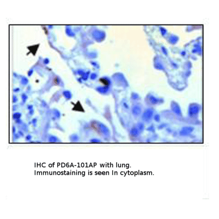 Anti-PDE6 Alpha Antibody from FabGennix (PD6A-101AP) - Antibodies.com