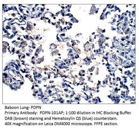 Anti-Podoplanin Antibody from FabGennix (PDPN-101AP) - Antibodies.com