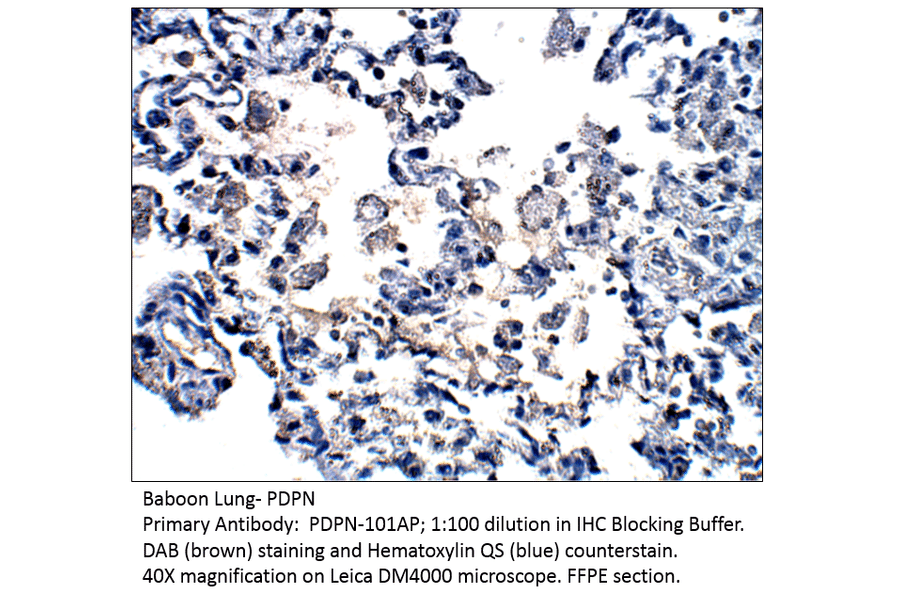 Anti-Podoplanin Antibody from FabGennix (PDPN-101AP) - Antibodies.com