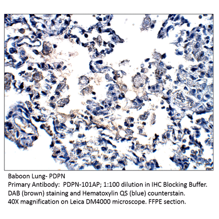 Anti-Podoplanin Antibody from FabGennix (PDPN-101AP) - Antibodies.com