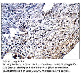 Anti-Podoplanin Antibody from FabGennix (PDPN-112AP) - Antibodies.com