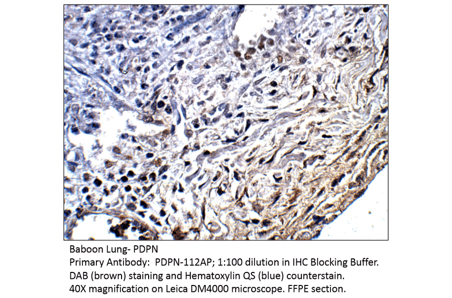 Anti-Podoplanin Antibody from FabGennix (PDPN-112AP) - Antibodies.com