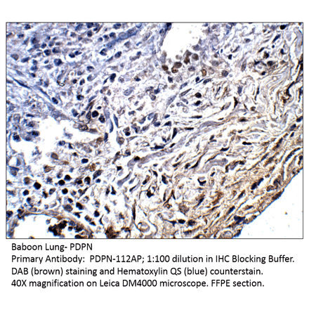 Anti-Podoplanin Antibody from FabGennix (PDPN-112AP) - Antibodies.com