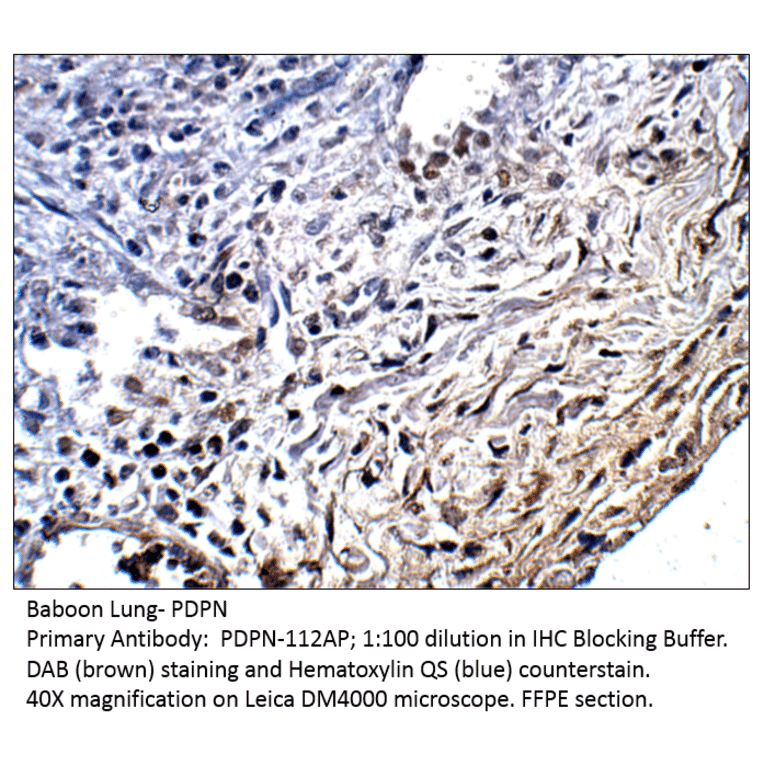 Anti-Podoplanin Antibody from FabGennix (PDPN-112AP) - Antibodies.com