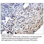 Anti-Podoplanin Antibody from FabGennix (PDPN-112AP) - Antibodies.com
