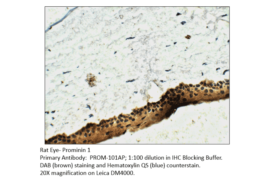 Anti-Prominin 1 Antibody from FabGennix (PROM-101AP) - Antibodies.com