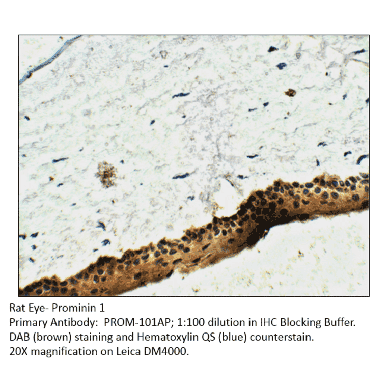 Anti-Prominin 1 Antibody from FabGennix (PROM-101AP) - Antibodies.com