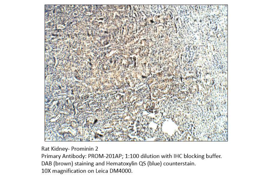 Anti-Prominin 2 Antibody from FabGennix (PROM-201AP) - Antibodies.com