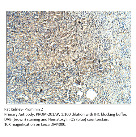 Anti-Prominin 2 Antibody from FabGennix (PROM-201AP) - Antibodies.com