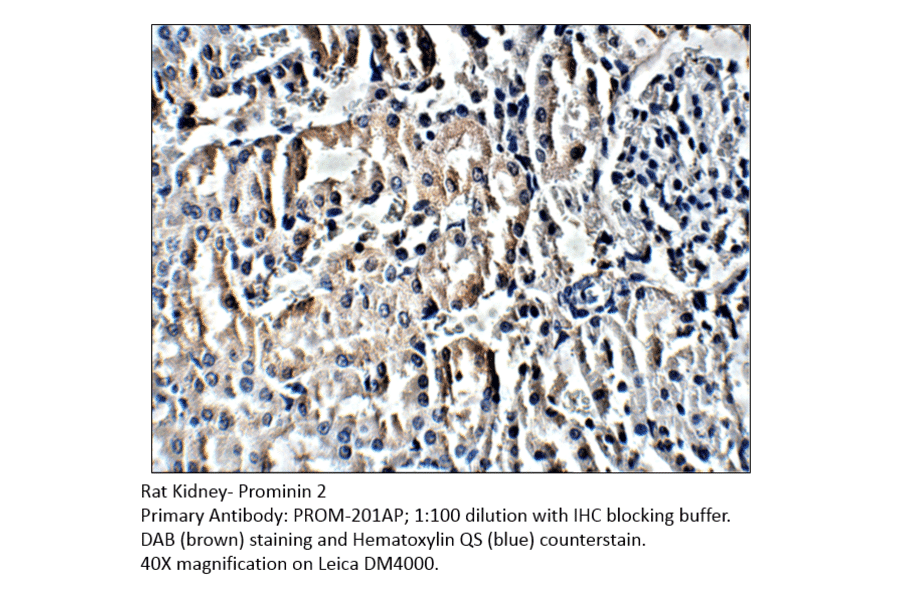 Anti-Prominin 2 Antibody from FabGennix (PROM-201AP) - Antibodies.com