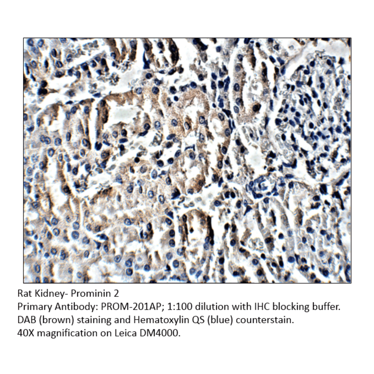 Anti-Prominin 2 Antibody from FabGennix (PROM-201AP) - Antibodies.com