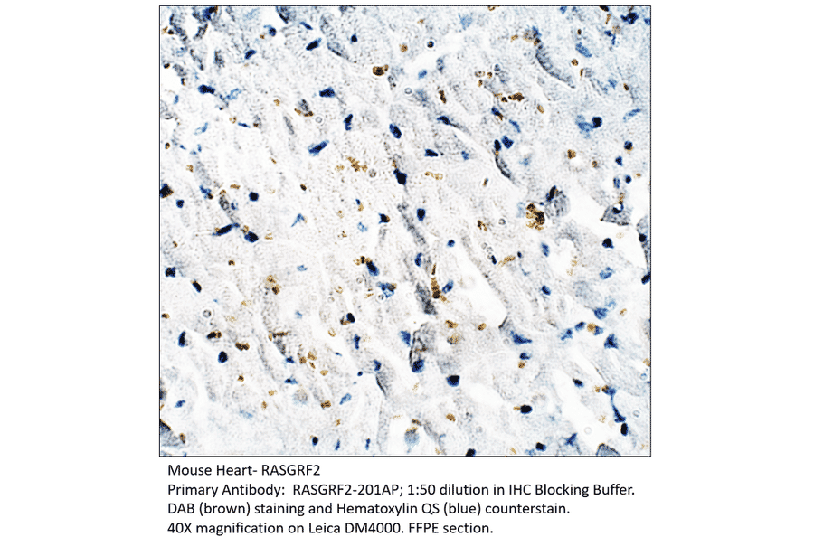 Anti-RASGRF2 Antibody from FabGennix (RASGRF2-201AP) - Antibodies.com