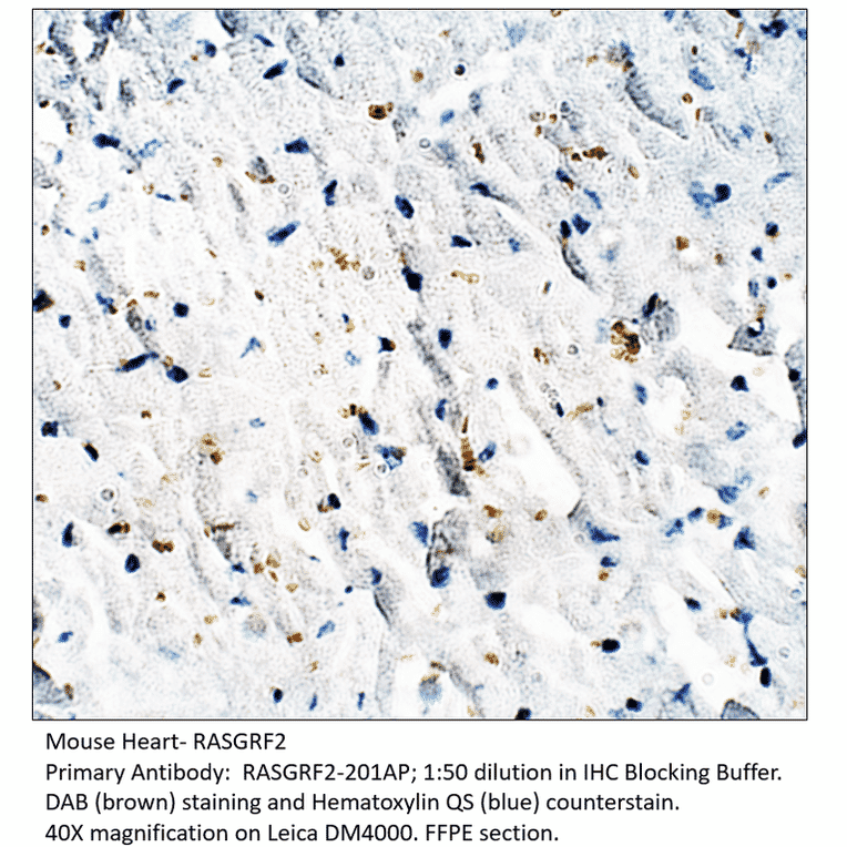 Anti-RASGRF2 Antibody from FabGennix (RASGRF2-201AP) - Antibodies.com
