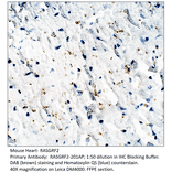 Anti-RASGRF2 Antibody from FabGennix (RASGRF2-201AP) - Antibodies.com