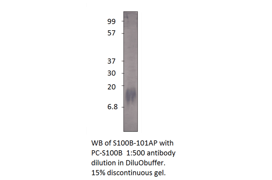 Anti-S100 beta Antibody from FabGennix (S100B-101AP) - Antibodies.com