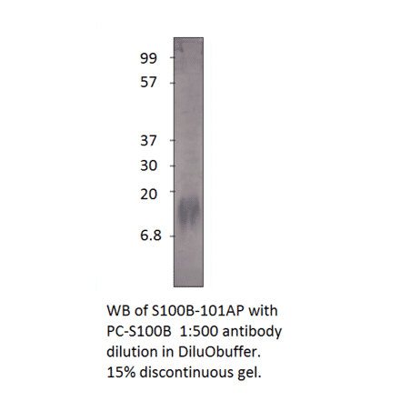 Anti-S100 beta Antibody from FabGennix (S100B-101AP) - Antibodies.com