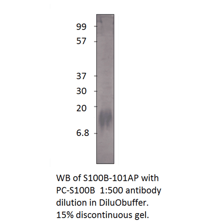 Anti-S100 beta Antibody from FabGennix (S100B-101AP) - Antibodies.com