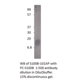 Anti-S100 beta Antibody from FabGennix (S100B-101AP) - Antibodies.com