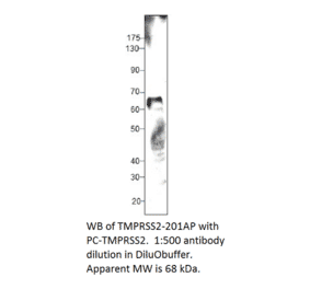 Anti-TMPRSS2 Antibody from FabGennix (TMPRSS2-201AP) - Antibodies.com