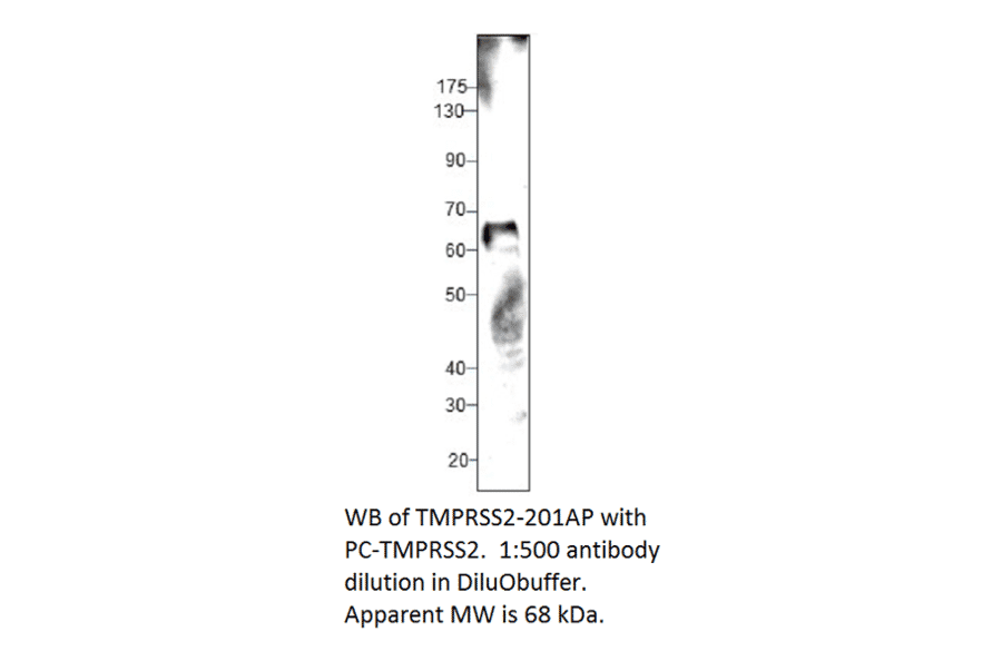Anti-TMPRSS2 Antibody from FabGennix (TMPRSS2-201AP) - Antibodies.com