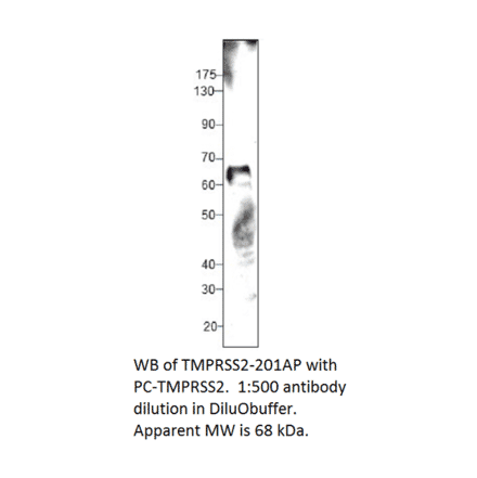 Anti-TMPRSS2 Antibody from FabGennix (TMPRSS2-201AP) - Antibodies.com