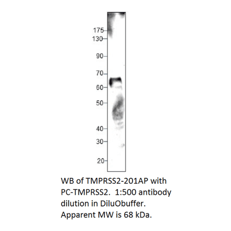 Anti-TMPRSS2 Antibody from FabGennix (TMPRSS2-201AP) - Antibodies.com