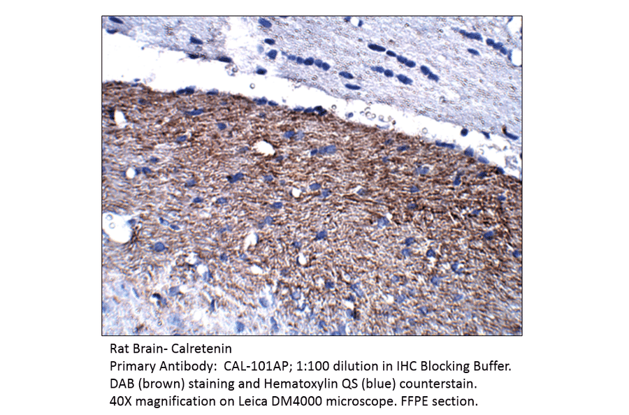 Anti-Calretinin Antibody from FabGennix (CAL-101AP) - Antibodies.com