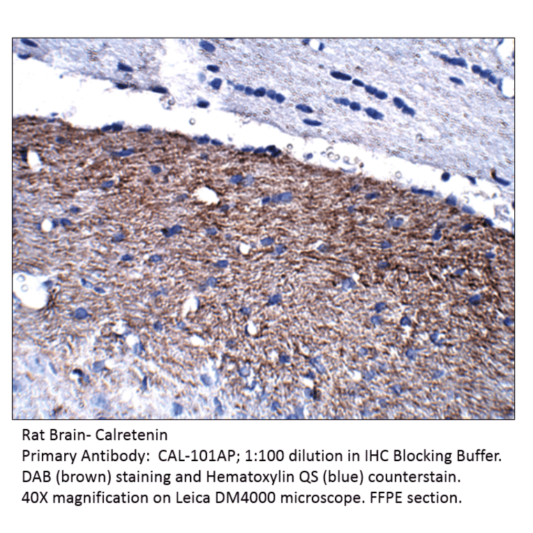 Anti-Calretinin Antibody from FabGennix (CAL-101AP) - Antibodies.com